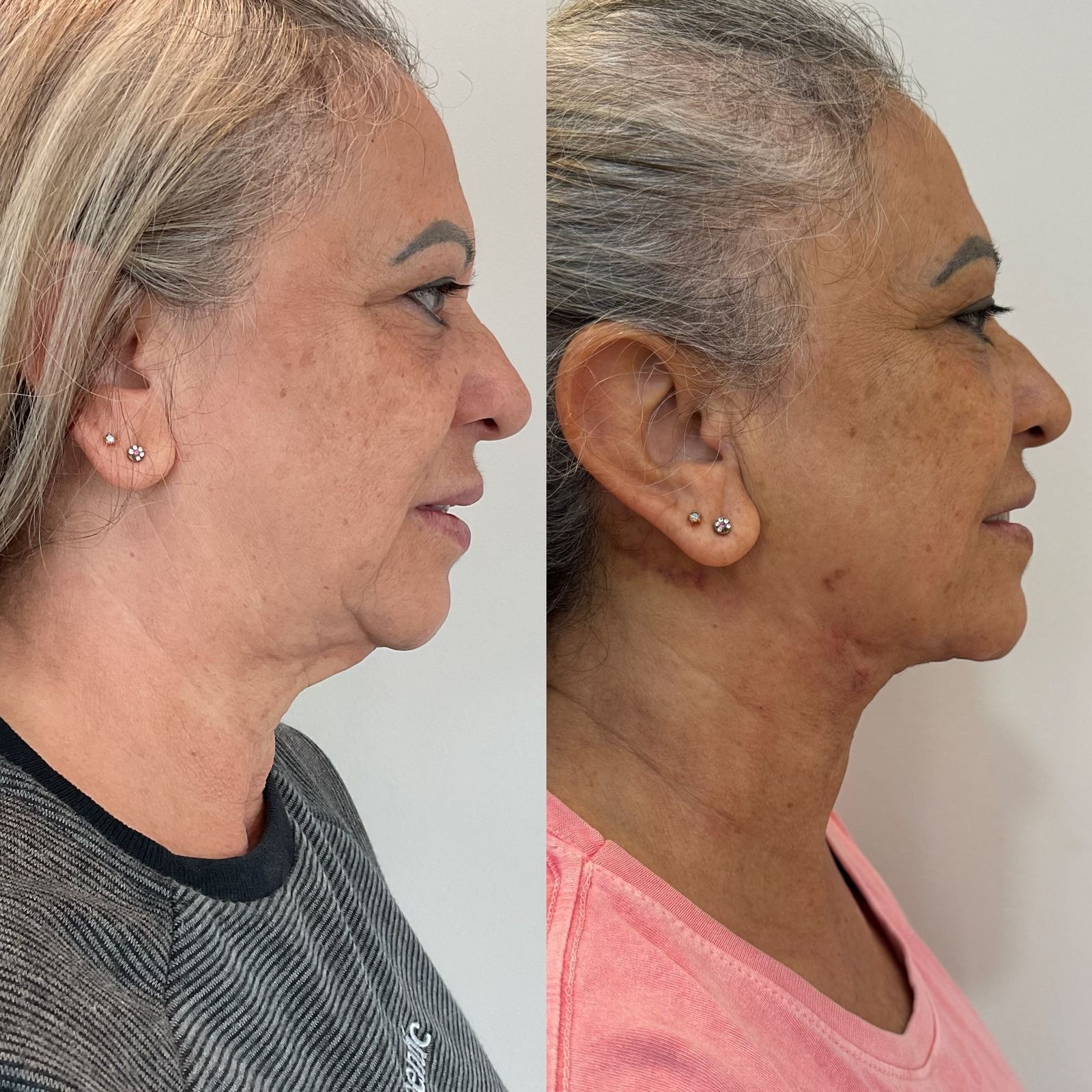 Imagem do WhatsApp de 2025-02-05 à(s) 11.31.37_b9996e11